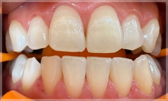 20代前半・女性
